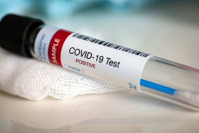 Число случаев COVID-19 в мире увеличилось за сутки более чем на 278 тысяч