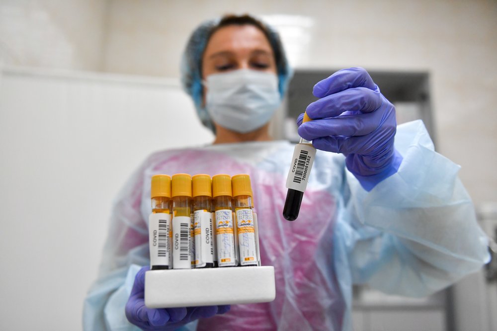 Российские ученые нашли новый способ тестирования на коронавирус