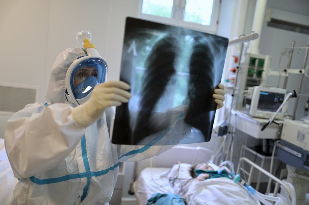 Оперштаб сообщил о снижении числа пневмоний в Москве за месяц