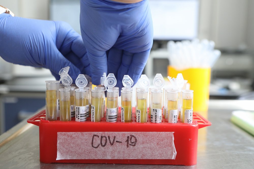 Москва выбилась в лидеры среди мировых мегаполисов по числу тестов на коронавирус