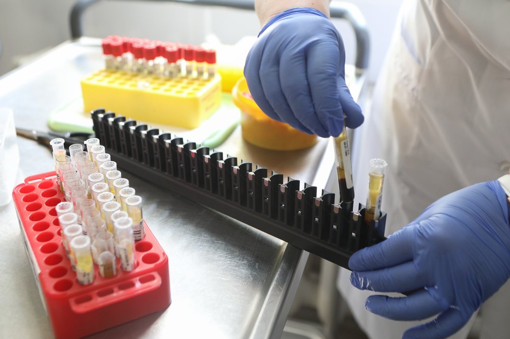 Количество тестов на антитела к COVID-19 увеличат в Подмосковье