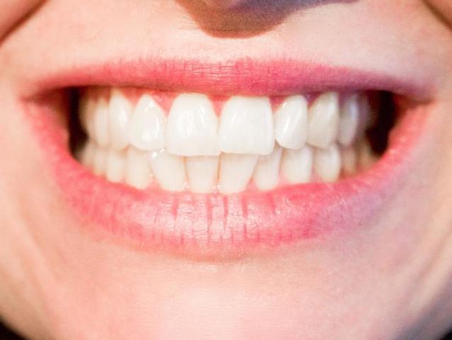 Нестареющая улыбка: как сохранить зубы до старости